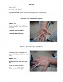 Swab Teste de Mãos