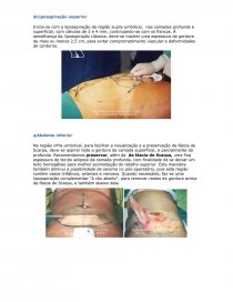 Lipoaspiração - Lipoescultura - Caso Clínico #37560